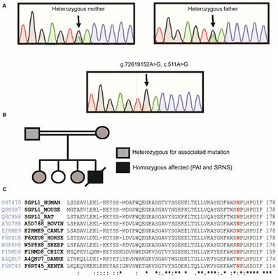 A Sphingosine-1-Phosphate Lyase Mutation Associated With Congenital Nephrotic Syndrome and Multiple Endocrinopathy